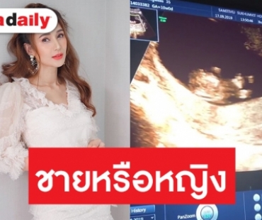 "เนย โชติกา" รับรู้เพศลูกคนที่ 2 แล้ว เผยเล็งปิดอู่หลังคลอด