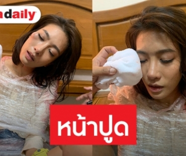 ฟาดเคราะห์! “ไอซ์” น้ำตาร่วงเกิดอุบัติเหตุกลางกองละคร 