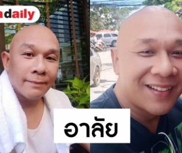 สุดเศร้า “โหน่งน้อย” จากไปด้วยโรคตับ