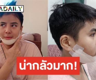 ศัลยกรรมทำพิษ! “นัท มาลิสา” หวิดจบอาชีพศิลปินเพราะฟิลเลอร์ปลอม