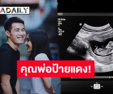 ต้อนรับสมาชิกใหม่ “สารัช อยู่เย็น” เผยภาพอัลตราซาวน์ลูกคนแรก! 