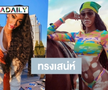 ส่องความเซ็กซี่ Winnie Harlow นางแบบด่างขาวที่มีผู้ติดตาม 7 ล้าน