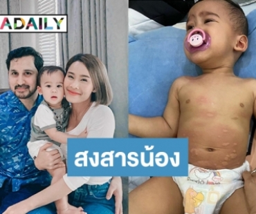 ต้องระวัง! “น้องวิน” ลูก “แม่หนูเล็ก” แพ้แป้งสาลี อาการเป็นแบบนี้