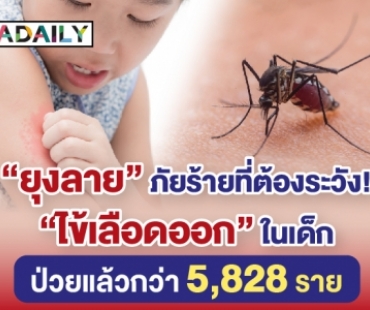 “ยุงลาย” ภัยร้ายที่ต้องระวัง! “ไข้เลือดออก” ในเด็ก ป่วยแล้วกว่า 5,828 ราย