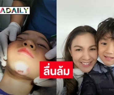 ซนจนได้แผล! “น้องณดล” ลูกชาย “กบ สุวนันท์” ลื่นล้ม จนคางแตก