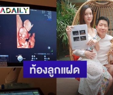 “จุ้มจิ้ม” ภรรยา “ภัทร จึงกานต์กุล” ประกาศข่าวดีท้องลูกแฝด ชมสามีดูแลดีเวอร์